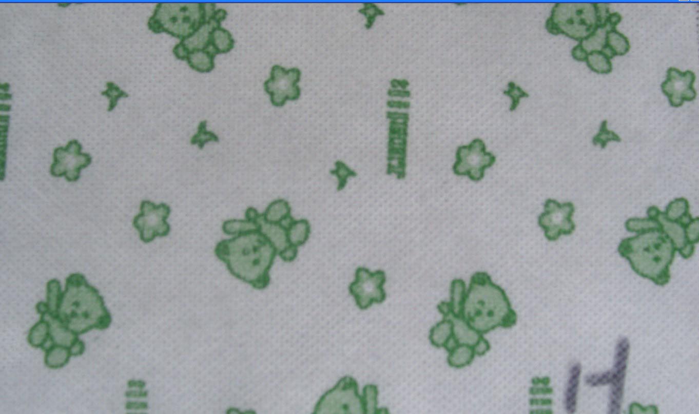 ӡ��1-1�o����